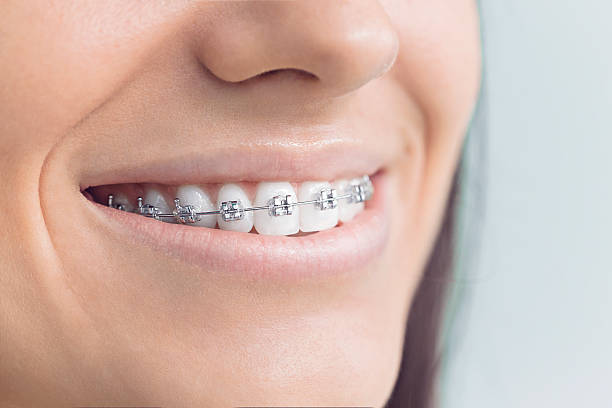 Laser Dentistry in Higginsville, MO